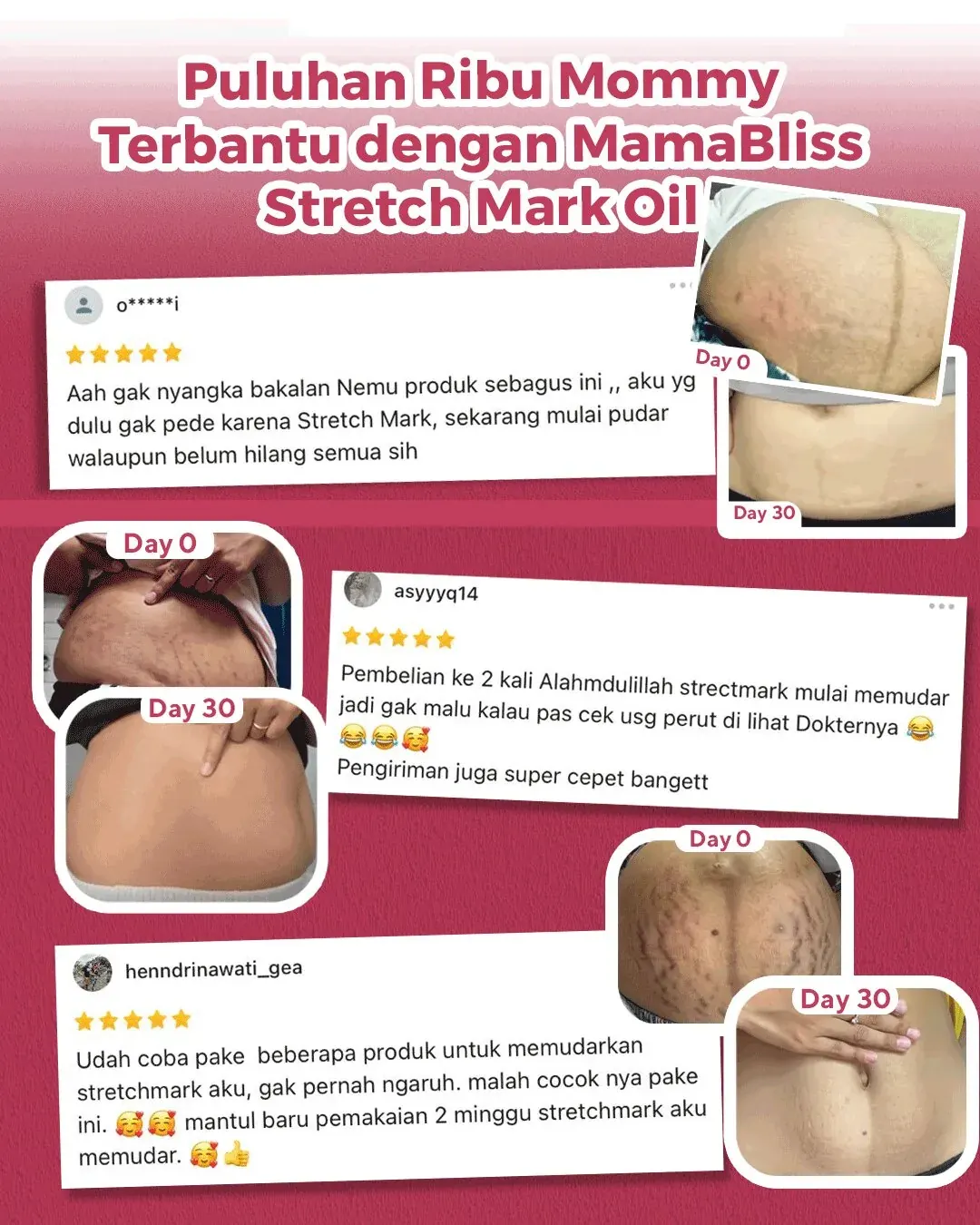 Ulasan pengguna MamaBliss Stretch Mark Oil